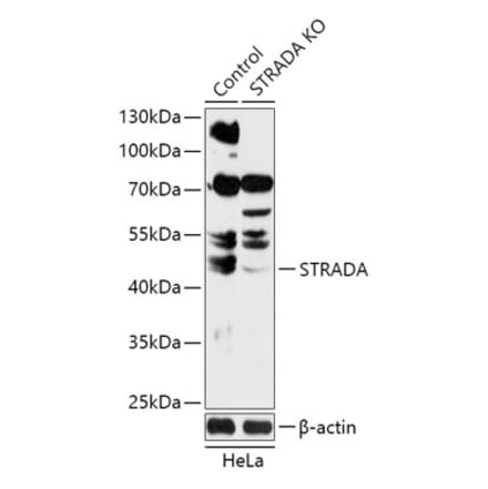 Western Blot - Anti-STRAD Antibody (A92952) - Antibodies.com