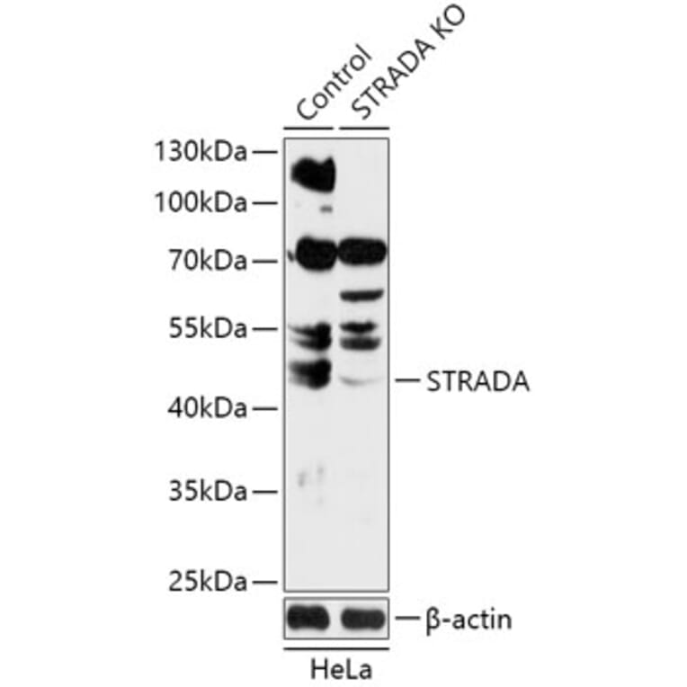 Western Blot - Anti-STRAD Antibody (A92952) - Antibodies.com