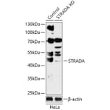 Western Blot - Anti-STRAD Antibody (A92952) - Antibodies.com