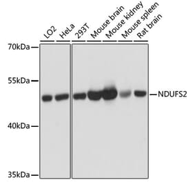 Western Blot - Anti-NDUFS2 Antibody (A92953) - Antibodies.com