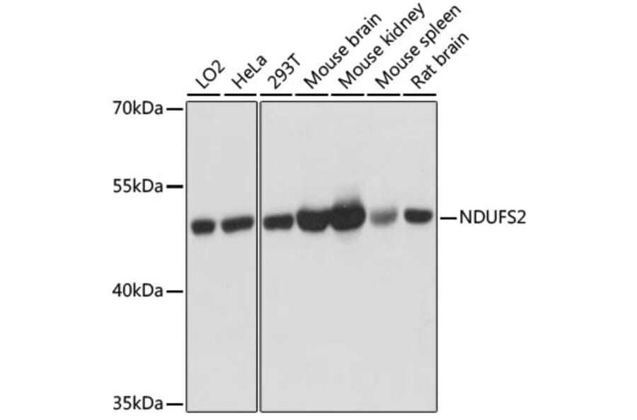 Western Blot - Anti-NDUFS2 Antibody (A92953) - Antibodies.com