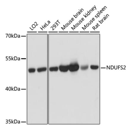 Western Blot - Anti-NDUFS2 Antibody (A92953) - Antibodies.com