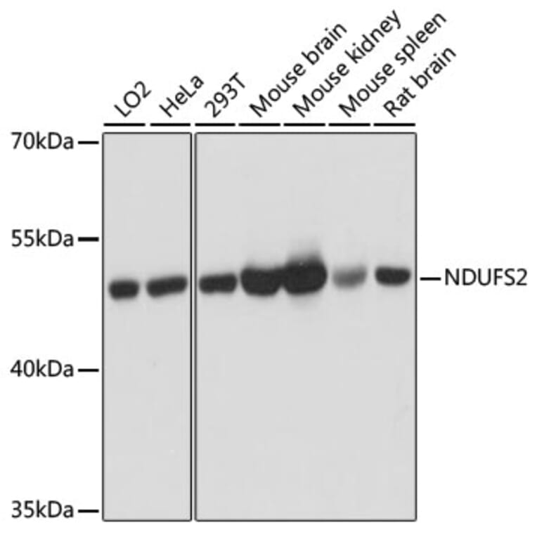 Western Blot - Anti-NDUFS2 Antibody (A92953) - Antibodies.com