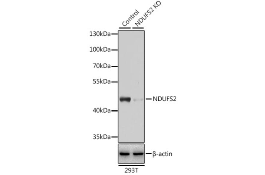 Western Blot - Anti-NDUFS2 Antibody (A92953) - Antibodies.com