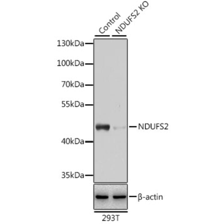 Western Blot - Anti-NDUFS2 Antibody (A92953) - Antibodies.com