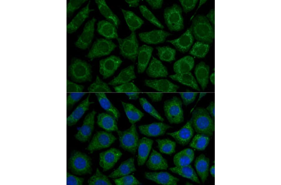 Immunofluorescence - Anti-NDUFS2 Antibody (A92953) - Antibodies.com