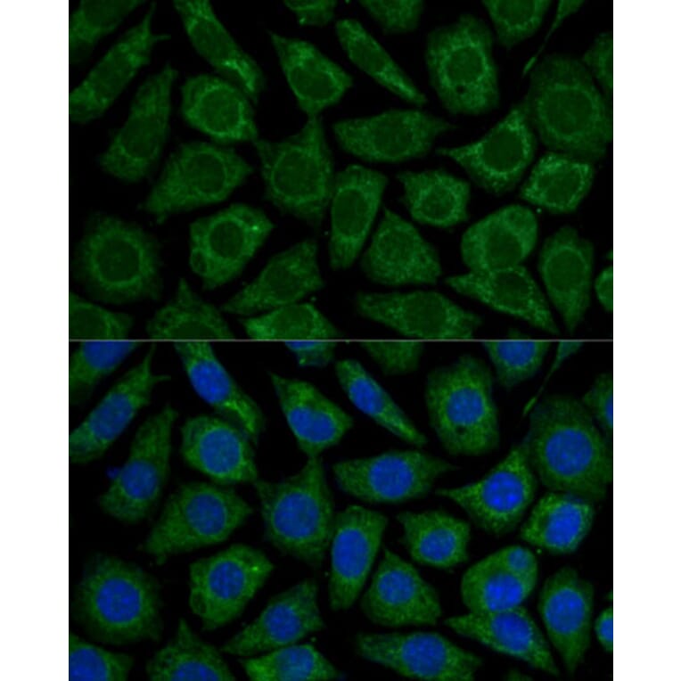 Immunofluorescence - Anti-NDUFS2 Antibody (A92953) - Antibodies.com