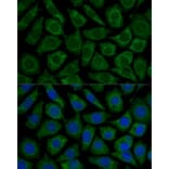 Immunofluorescence - Anti-NDUFS2 Antibody (A92953) - Antibodies.com