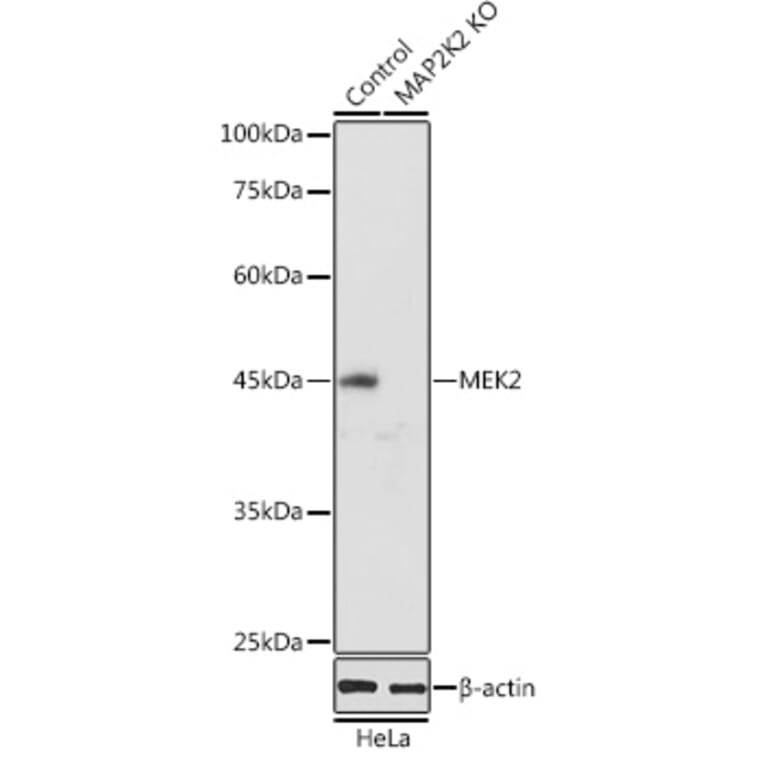 Western Blot - Anti-MEK2 Antibody (A92954) - Antibodies.com