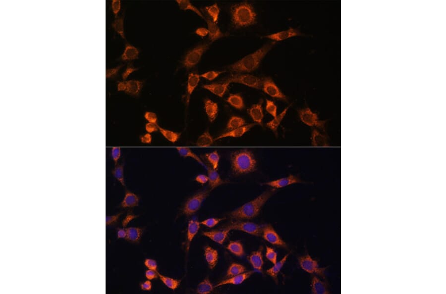 Immunofluorescence - Anti-MEK2 Antibody (A92954) - Antibodies.com