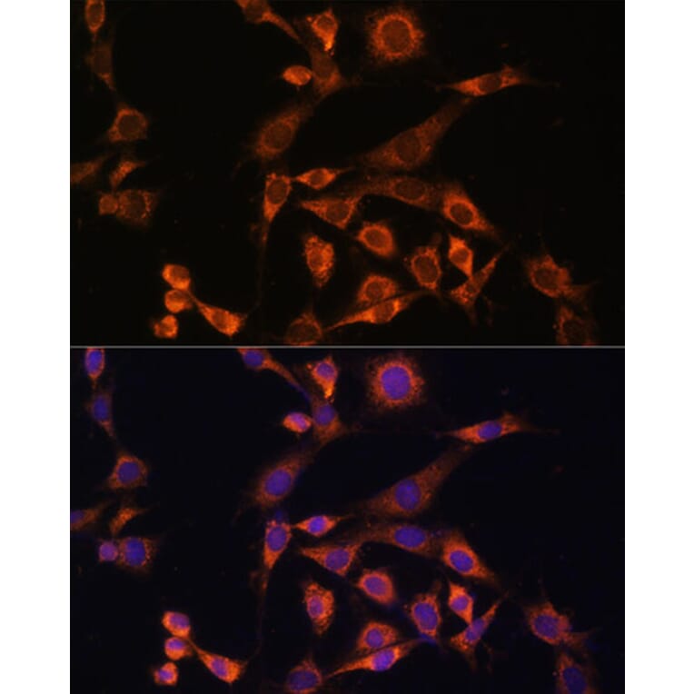 Immunofluorescence - Anti-MEK2 Antibody (A92954) - Antibodies.com
