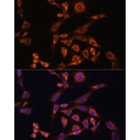 Immunofluorescence - Anti-MEK2 Antibody (A92954) - Antibodies.com
