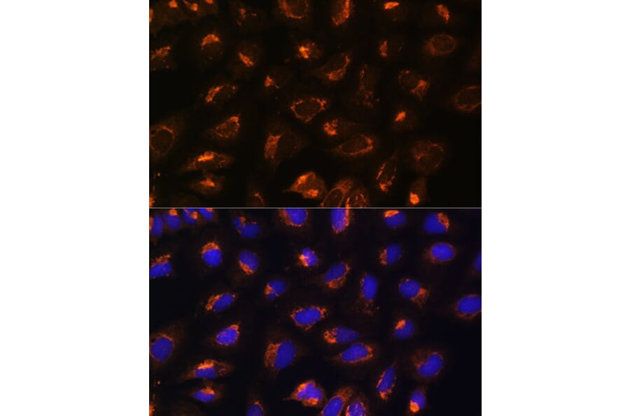 Immunofluorescence - Anti-MEK2 Antibody (A92954) - Antibodies.com
