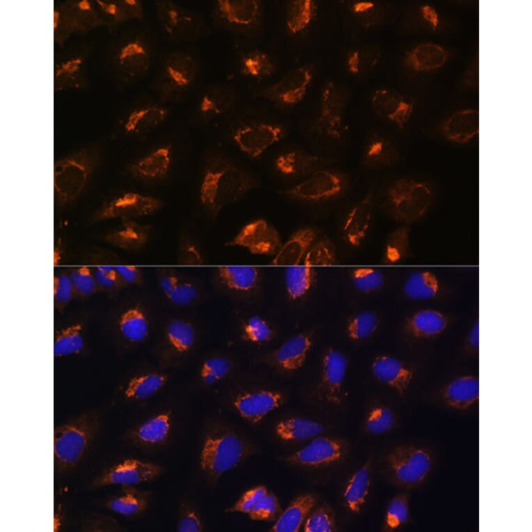 Immunofluorescence - Anti-MEK2 Antibody (A92954) - Antibodies.com