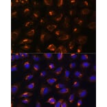 Immunofluorescence - Anti-MEK2 Antibody (A92954) - Antibodies.com