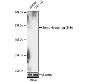 Western Blot - Anti-Sonic Hedgehog Antibody (A92955) - Antibodies.com