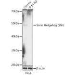 Western Blot - Anti-Sonic Hedgehog Antibody (A92955) - Antibodies.com