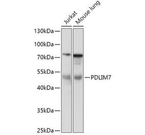 Western Blot - Anti-PDLIM7 Antibody (A92958) - Antibodies.com