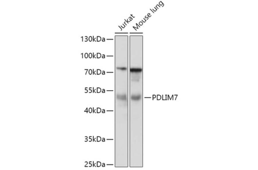Western Blot - Anti-PDLIM7 Antibody (A92958) - Antibodies.com