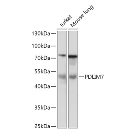 Western Blot - Anti-PDLIM7 Antibody (A92958) - Antibodies.com