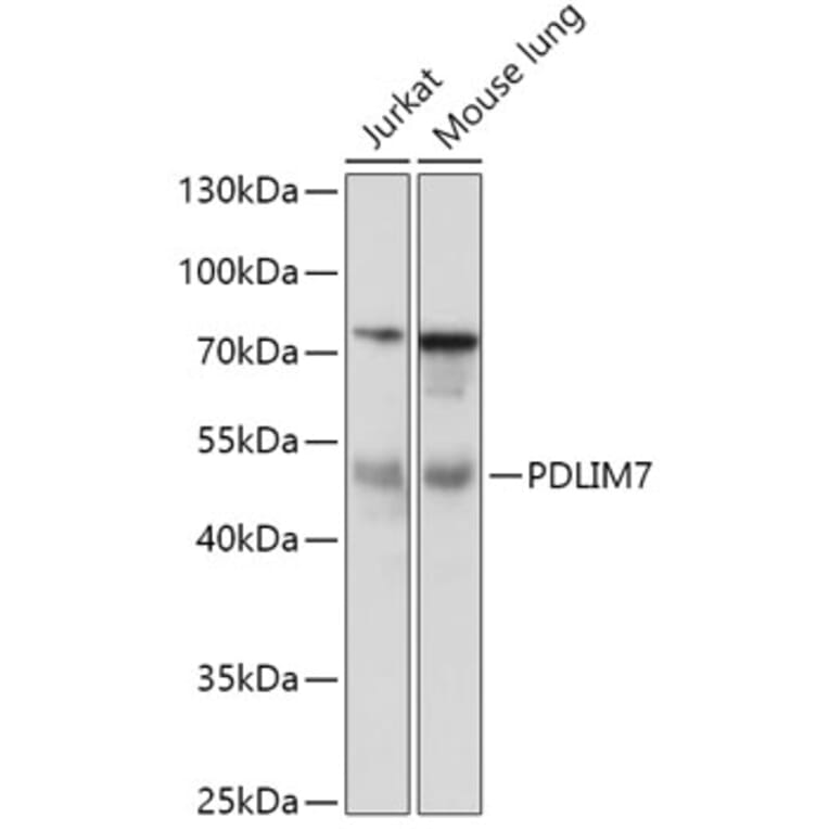 Western Blot - Anti-PDLIM7 Antibody (A92958) - Antibodies.com