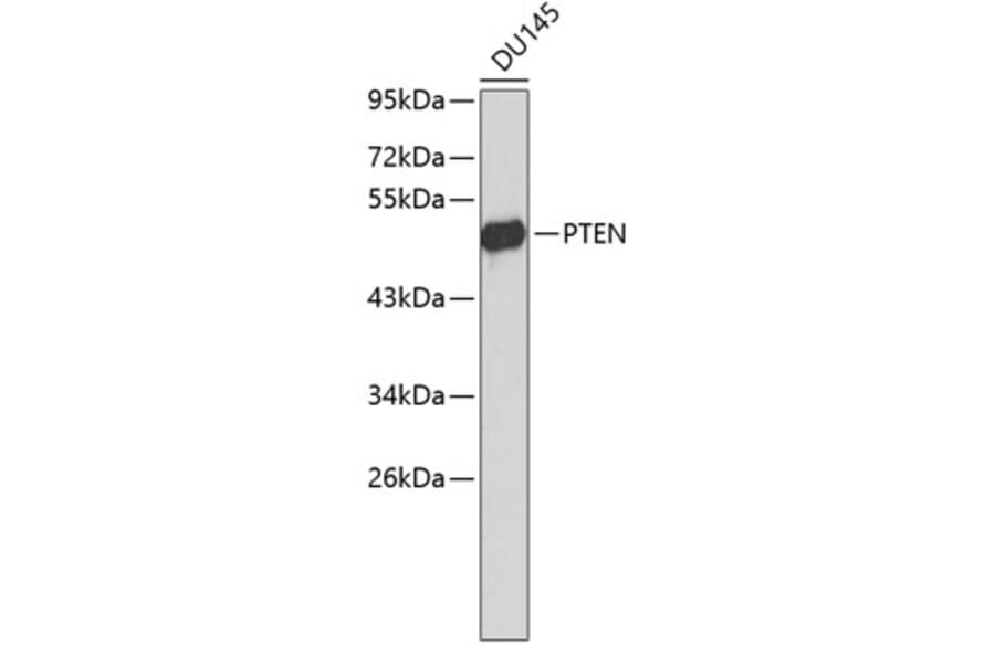 Western Blot - Anti-PTEN Antibody (A6261) - Antibodies.com