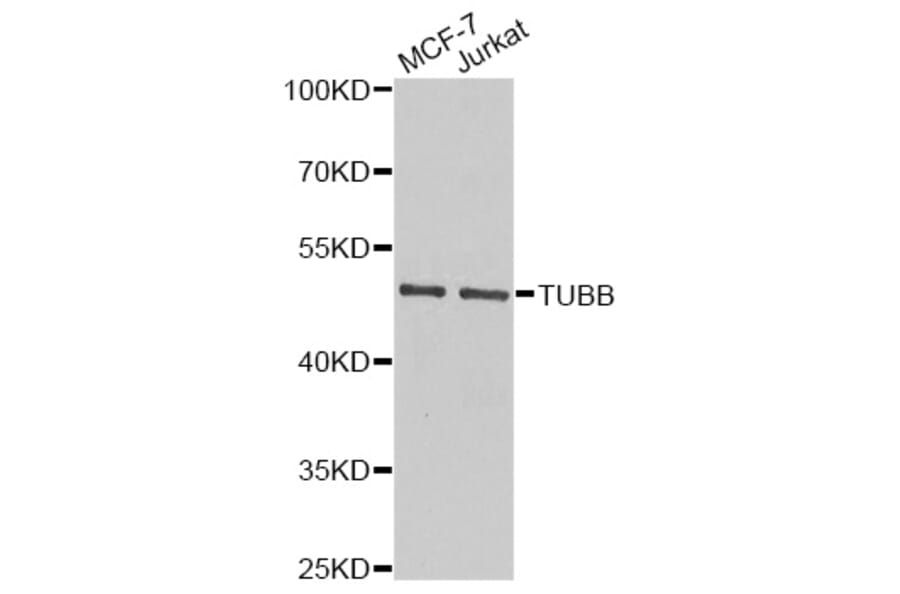 Western Blot - Anti-Beta Tubulin Antibody (A14991) - Antibodies.com