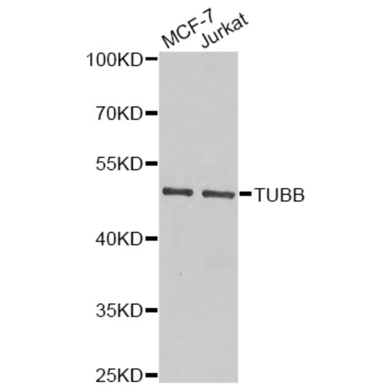 Western Blot - Anti-Beta Tubulin Antibody (A14991) - Antibodies.com