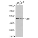 Western Blot - Anti-Beta Tubulin Antibody (A14991) - Antibodies.com