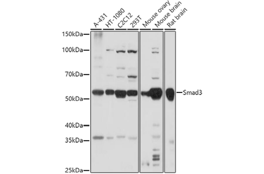 Western Blot - Anti-Smad3 Antibody (A92961) - Antibodies.com