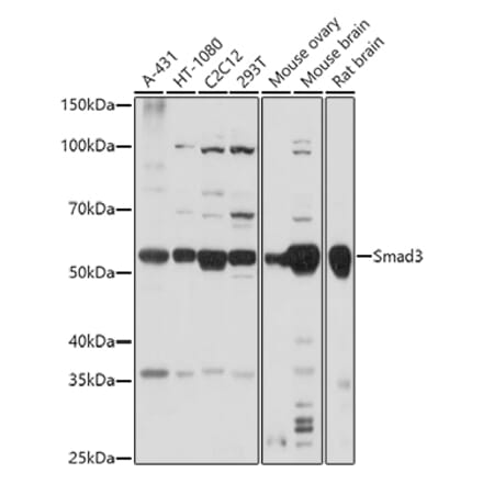 Western Blot - Anti-Smad3 Antibody (A92961) - Antibodies.com