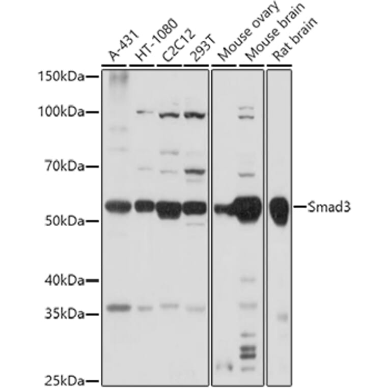 Western Blot - Anti-Smad3 Antibody (A92961) - Antibodies.com