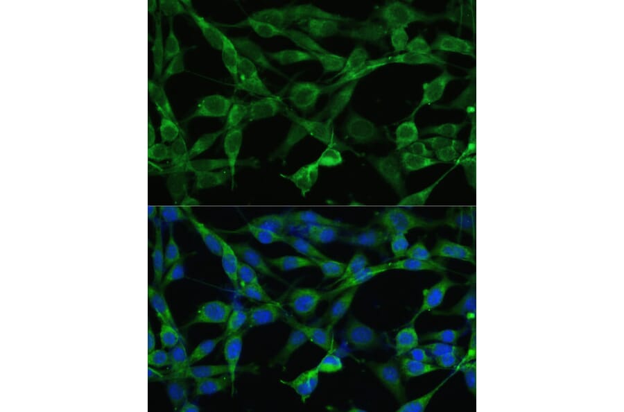 Anti-Smad3 Antibody (A92961) | Antibodies.com