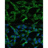 Immunofluorescence - Anti-Smad3 Antibody (A92961) - Antibodies.com