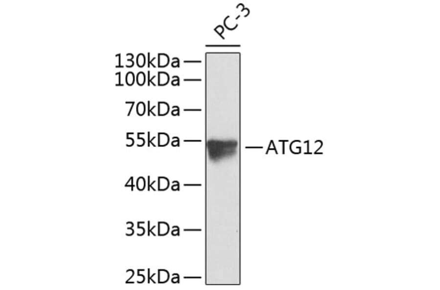 Western Blot - Anti-ATG12 Antibody (A8078) - Antibodies.com