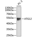 Western Blot - Anti-ATG12 Antibody (A8078) - Antibodies.com