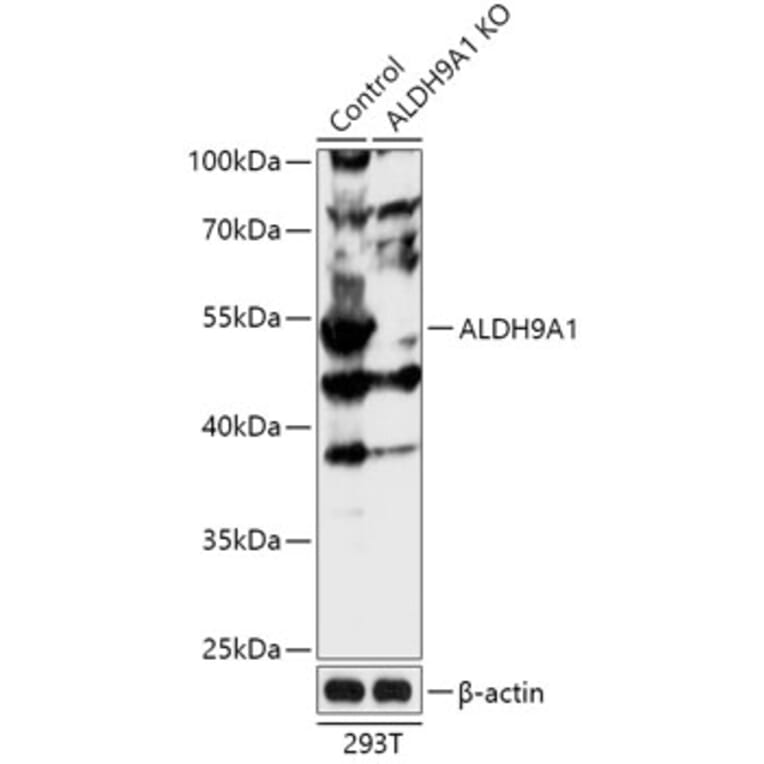 Western Blot - Anti-ALDH9A1 Antibody (A92966) - Antibodies.com