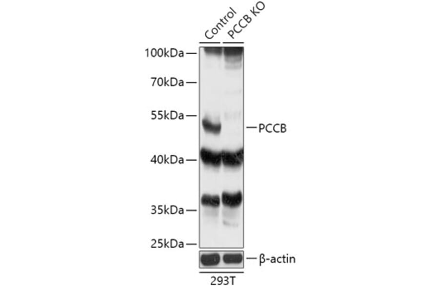 Western Blot - Anti-PCCB Antibody (A92967) - Antibodies.com