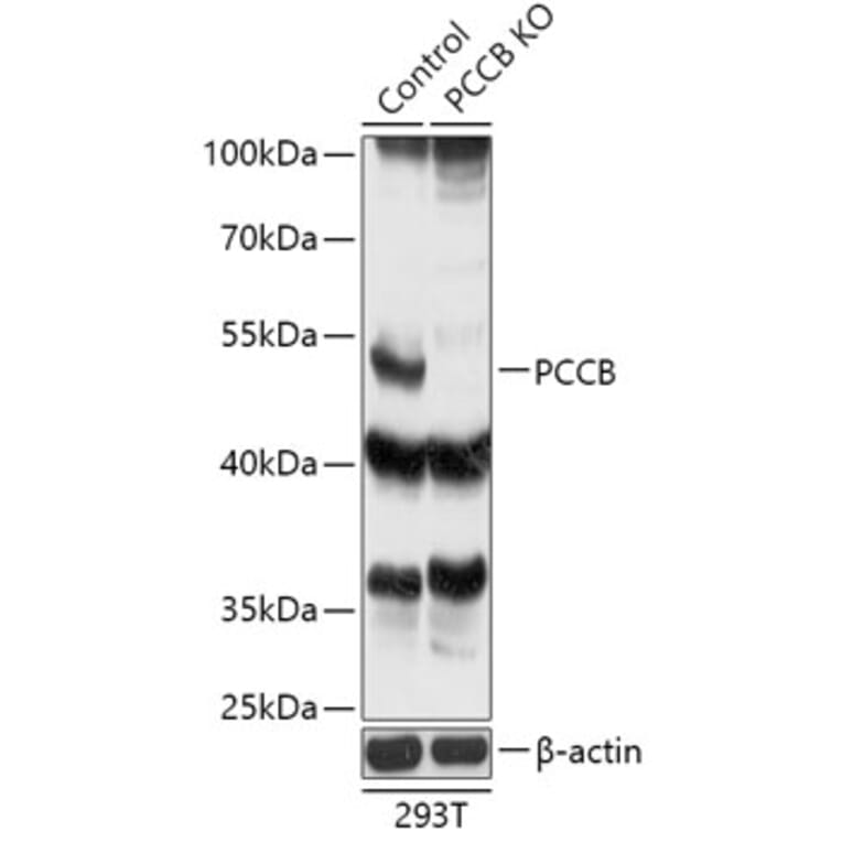 Western Blot - Anti-PCCB Antibody (A92967) - Antibodies.com