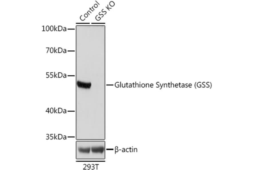 Western Blot - Anti-Glutathione Synthetase Antibody (A92968) - Antibodies.com
