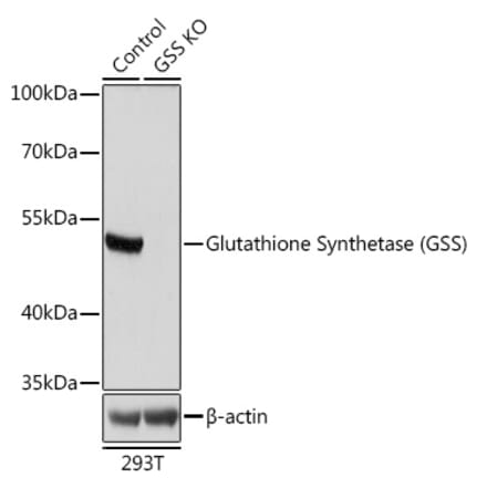 Western Blot - Anti-Glutathione Synthetase Antibody (A92968) - Antibodies.com