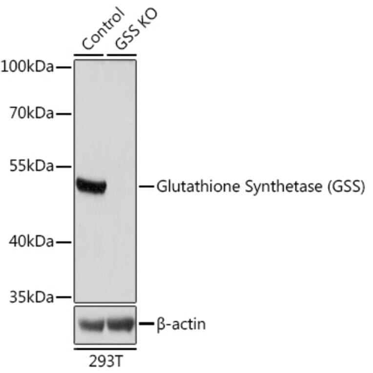 Western Blot - Anti-Glutathione Synthetase Antibody (A92968) - Antibodies.com
