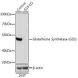 Western Blot - Anti-Glutathione Synthetase Antibody (A92968) - Antibodies.com