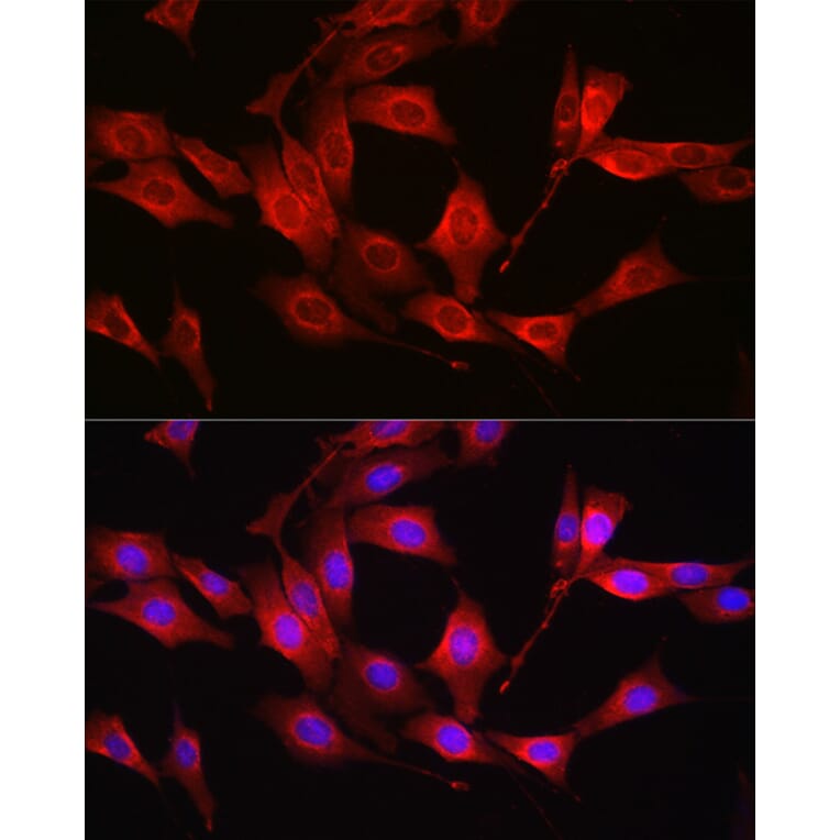 Immunofluorescence - Anti-Glutathione Synthetase Antibody (A92968) - Antibodies.com