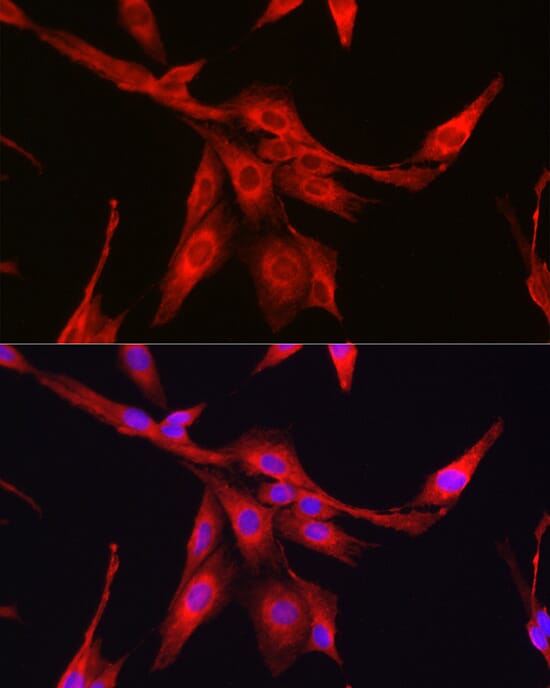 Anti-Glutathione Synthetase Antibody (A92968)