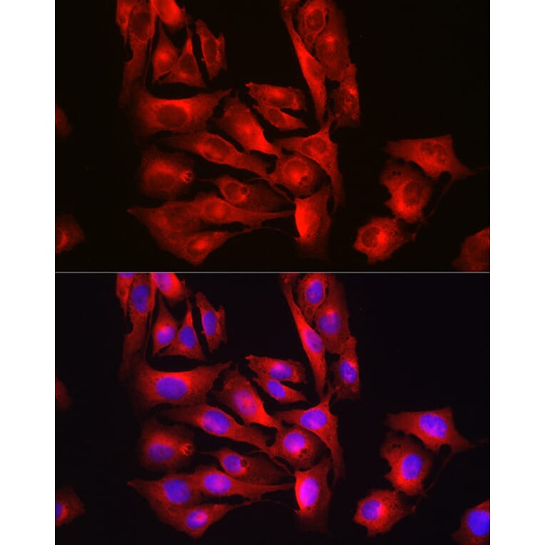 Immunofluorescence - Anti-Glutathione Synthetase Antibody (A92968) - Antibodies.com
