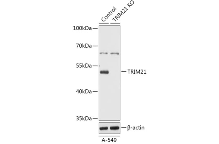 Western Blot - Anti-TRIM21 / SS-A Antibody (A92969) - Antibodies.com