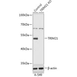 Western Blot - Anti-TRIM21 / SS-A Antibody (A92969) - Antibodies.com