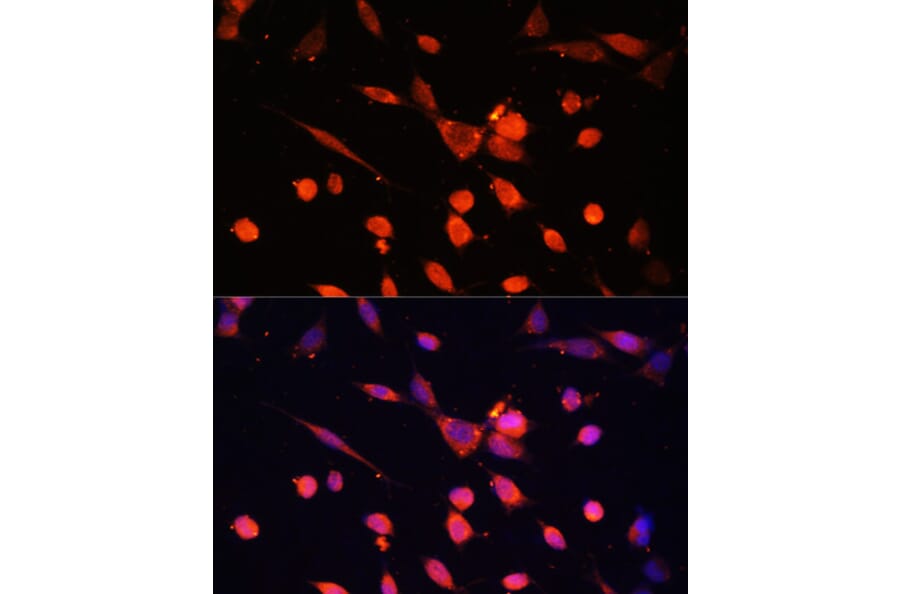 Immunofluorescence - Anti-PI 3 Kinase p55 gamma Antibody (A92970) - Antibodies.com