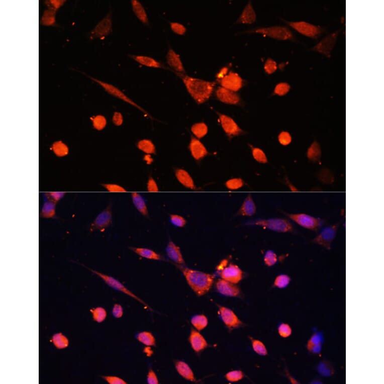 Immunofluorescence - Anti-PI 3 Kinase p55 gamma Antibody (A92970) - Antibodies.com